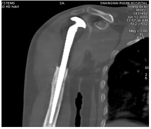 ʯVCTGE߶CT