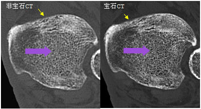 ʯVCTGE߶CT
