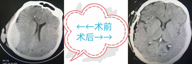 (jng)