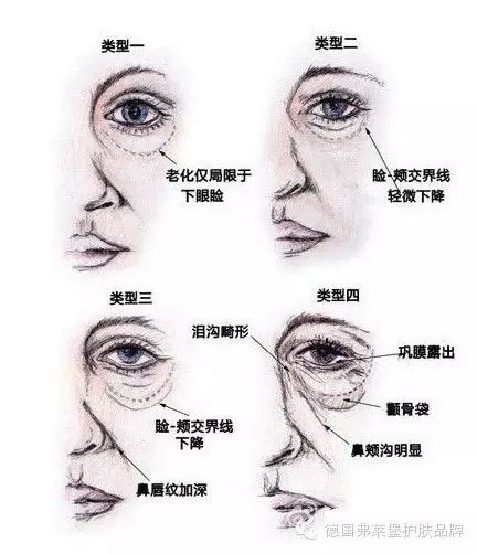 ĳеt(y)Ժܰʾ籭ҹΣ֪᣿