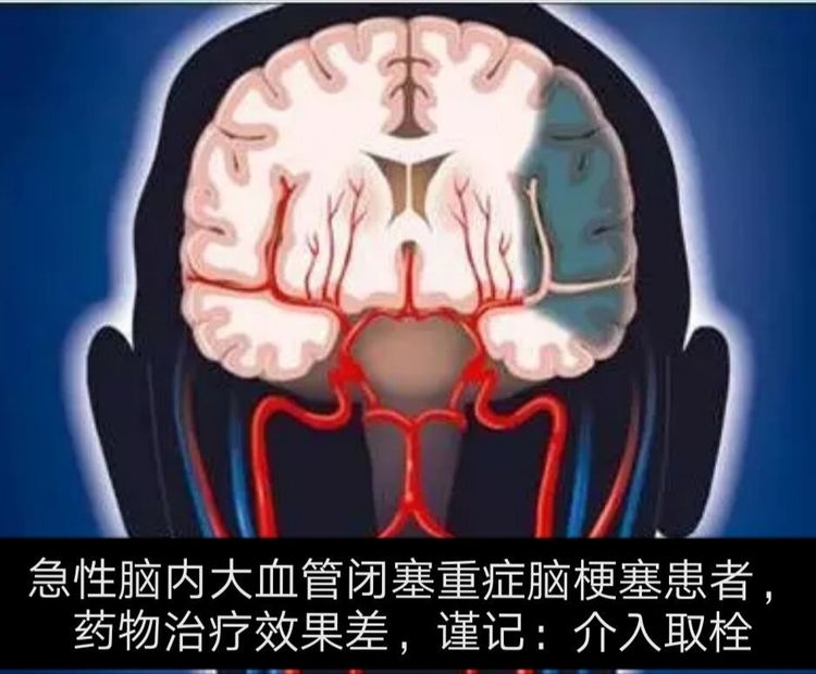 ĳԺ조¡g(sh)һ5_(ti)΢(chung)ƫc